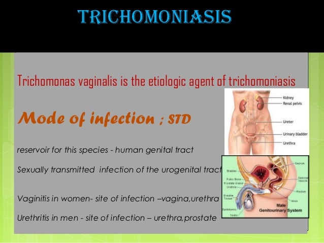 photos of vaginal trichomonas infection Hub tila tequilla xxx